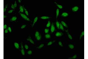 Immunofluorescence staining of Hela cells with ABIN7157190 at 1:100, counter-stained with DAPI. (Kallikrein 1 抗体  (AA 25-262))