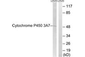 Western blot analysis of extracts from LOVO cells, using Cytochrome P450 3A7 Antibody. (CYP3A7 抗体  (AA 231-280))
