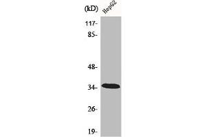 Western Blot analysis of HepG2 cells using CA XIII Polyclonal Antibody