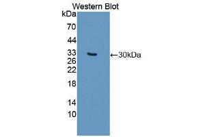Western blot analysis of the recombinant protein. (MYO1F 抗体  (AA 655-922))