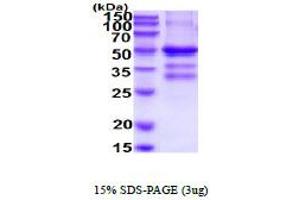SDS-PAGE (SDS) image for Tumor Necrosis Factor Receptor Superfamily, Member 13B (TNFRSF13B) (AA 1-165) protein (hIgG-His-tag) (ABIN5854629)