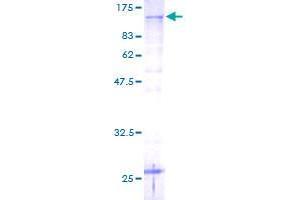 PSMD2 Protein (AA 1-908) (GST tag)