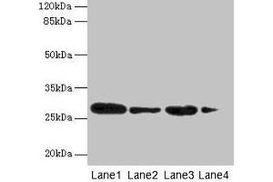 Western blot All lanes: MED7 antibody at 6 μg/mL Lane 1: Jurkat whole cell lysate Lane 2: Hela whole cell lysate Lane 3: Mouse thymus tissue Lane 4: NIH/3T3 whole cell lysate Secondary Goat polyclonal to rabbit IgG at 1/10000 dilution Predicted band size: 28 kDa Observed band size: 28 kDa (MED7 抗体  (AA 1-233))