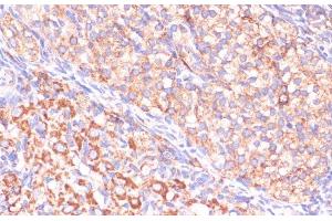 Immunohistochemistry of paraffin-embedded Rat ovary using VHL Polyclonal Antibody at dilution of 1:200 (40x lens). (VHL 抗体)