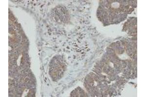 Immunohistochemistry (Paraffin-embedded Sections) (IHC (p)) image for anti-Protein Phosphatase, Mg2+/Mn2+ Dependent, 1K (PPM1K) (AA 1-324), (N-Term) antibody (ABIN497953)