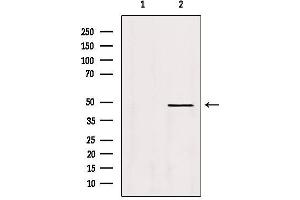 Western blot analysis of extracts from Hela, using DEK Antibody. (DEK 抗体  (Internal Region))
