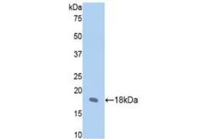 Detection of Recombinant FBN1, Rat using Polyclonal Antibody to Fibrillin 1 (FBN1) (Fibrillin 1 抗体  (AA 751-895))