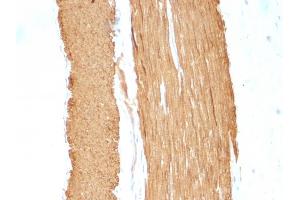Immunohistochemistry (IHC) image for anti-Actin, alpha 2, Smooth Muscle, Aorta (ACTA2) (N-Term) antibody (ABIN6940521)
