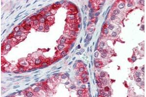 Anti-SKP2 antibody IHC staining of human prostate. (SKP2 抗体  (AA 221-425))