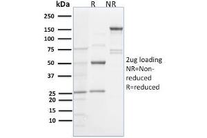 SDS-PAGE Analysis Purified Spastin Mouse Monoclonal Antibody (Sp 6C6). (Spastin 抗体)