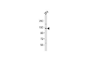 Anti-stk10 Antibody (Center)at 1:2000 dilution + ZF4 whole cell lysates Lysates/proteins at 20 μg per lane. (STK10-A 抗体  (AA 342-376))