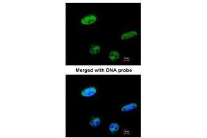 ICC/IF Image Immunofluorescence analysis of paraformaldehyde-fixed HeLa, using RASSF1, antibody at 1:100 dilution. (RASSF1 抗体  (Center))