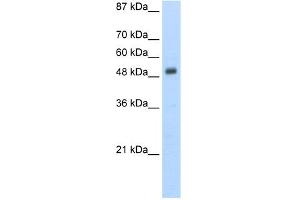 WB Suggested Anti-DES Antibody Titration:  5. (Desmin 抗体  (N-Term))