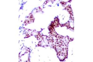 Immunohistochemistry (IHC) image for anti-Nuclear Factor-kB p65 (NFkBP65) (pSer276) antibody (ABIN1682005) (NF-kB p65 抗体  (pSer276))