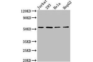 Western Blot Positive WB detected in: Jurkat whole cell lysate, 293 whole cell lysate, Hela whole cell lysate, HepG2 whole cell lysate All lanes: SLC16A12 antibody at 3 μg/mL Secondary Goat polyclonal to rabbit IgG at 1/50000 dilution Predicted band size: 54 kDa Observed band size: 54 kDa (SLC16A12 抗体  (AA 431-486))