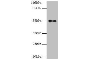 Western blot All lanes: THRA antibody at 2 μg/mL + A431 whole cell lysate Secondary Goat polyclonal to rabbit IgG at 1/10000 dilution Predicted band size: 55, 47, 51 kDa Observed band size: 55 kDa (THRA 抗体  (AA 1-490))
