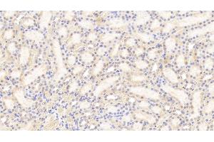 Immunohistochemistry (IHC) image for anti-Transient Receptor Potential Cation Channel, Subfamily M, Member 7 (TRPM7) (AA 19-179) antibody (ABIN7436144)