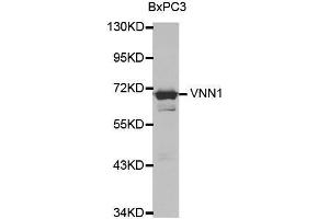 Western blot analysis of extracts of various cell lines, using VNN1 antibody. (VNN1 抗体  (AA 300-415))