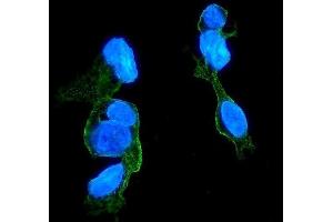 IF analysis of CCR2 using anti-CCR2 antibody (ABIN7598970).