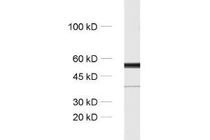 dilution: 1 : 1000, sample: rat brain homogenate (TUBB3 抗体)