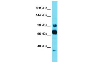 Host: Rabbit Target Name: CCDC178 Sample Type: HT1080 Whole Cell lysates Antibody Dilution: 1. (CCDC178 抗体  (C-Term))
