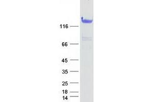 Western Blotting (WB) image for Histone Deacetylase 6 (HDAC6) protein (Myc-DYKDDDDK Tag) (ABIN2722518)