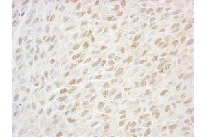 Immunohistochemistry (IHC) image for anti-SSB1 (AA 161-211) antibody (ABIN7448816) (SSB1 (AA 161-211) 抗体)