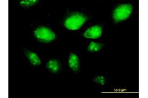 Immunofluorescence of purified MaxPab antibody to HSPA2 on HeLa cell. (HSPA2 抗体  (AA 1-639))