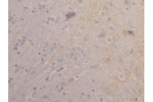 Detection of TM in Rat Cerebrum Tissue using Polyclonal Antibody to Thrombomodulin (TM) (Thrombomodulin 抗体  (AA 324-480))