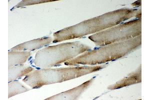 Immunohistochemistry (IHC) image for anti-Metadherin (MTDH) (AA 101-270) antibody (ABIN3043367)
