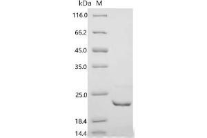 (Tris-Glycine gel) Discontinuous SDS-PAGE (reduced) with 5 % enrichment gel and 15 % separation gel.