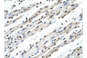 RCE1 antibody was used for immunohistochemistry at a concentration of 4-8 ug/ml to stain Skeletal muscle cells (arrows) in Human Muscle. (RCE1/FACE2 抗体)