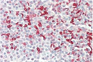 ABIN5539536 (5µg/ml) staining of paraffin embedded Human Spleen. (HMBS 抗体  (AA 160-173))