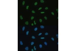 Immunofluorescence analysis of U-2 OS cells using MKL1 Polyclonal Antibody  at dilution of 1:100 (40x lens). (MKL1 抗体  (AA 1-280))