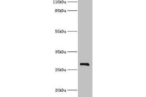 Western blot All lanes: HSD17B14 antibody at 2 μg/mL + Mouse kidney tissue Secondary Goat polyclonal to rabbit IgG at 1/10000 dilution Predicted band size: 29 kDa Observed band size: 29 kDa (HSD17B14 抗体  (AA 1-270))