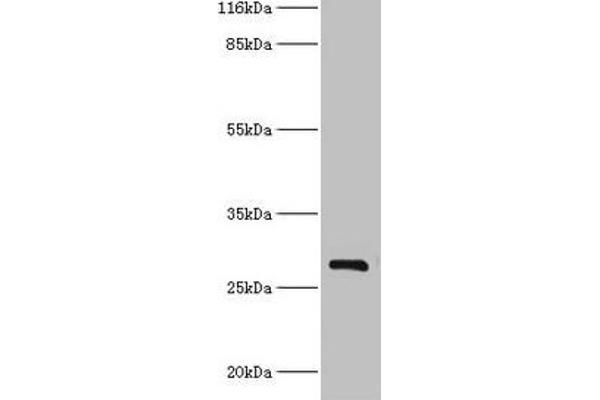 HSD17B14 抗体  (AA 1-270)
