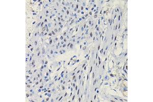 Immunohistochemistry of paraffin-embedded mouse uterus using Progesterone Receptor Rabbit pAb (ABIN6128570, ABIN6145518, ABIN6145519 and ABIN6213802) at dilution of 1:100 (40x lens). (Progesterone Receptor 抗体  (AA 1-250))