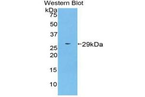 Western blot analysis of the recombinant protein. (Transportin 1 抗体  (AA 593-836))