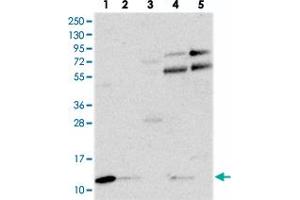 Western blot analysis of Lane 1: RT-4, Lane 2: U-251 MG, Lane 3: Human Plasma, Lane 4: Liver, Lane 5: Tonsil with C18orf32 polyclonal antibody  at 1:250-1:500 dilution. (C18orf32 抗体)
