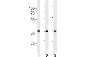 UCH37 antibody western blot analysis in 293, HeLa, 293T lysate.