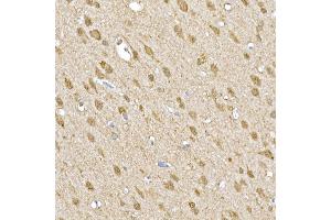 Immunohistochemistry of paraffin-embedded rat brain using SOCS1 Rabbit pAb (ABIN6128737, ABIN6148263, ABIN6148266 and ABIN6223700) at dilution of 1:250 (40x lens).