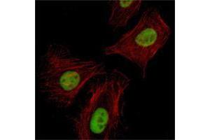 Immunofluorescence analysis of Hela cells using Pirh2 mouse mAb (green). (RCHY1 抗体)