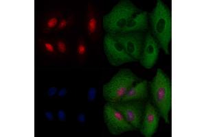 ABIN6256973 and ABIN6274518 staining  cells by IF/ICC. (BRMS1 抗体  (N-Term))