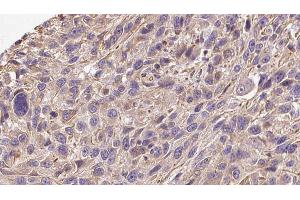Immunohistochemistry (IHC) image for anti-Collagen, Type XIX, alpha 1 (COL19A1) antibody (ABIN6260931)