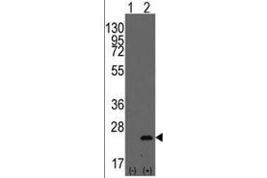 Western blot analysis of BarX1(arrow) using rabbit polyclonal BarX1 Antibody (C-term) . (BARX1 抗体  (Middle Region))