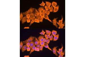 Immunofluorescence analysis of HeLa cells using RPL23 antibody (ABIN1682575, ABIN5664722, ABIN5664724 and ABIN6220574) at dilution of 1:100. (RPL23 抗体  (AA 1-140))