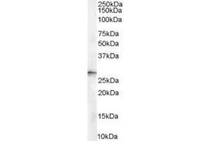 Image no. 2 for anti-Stratifin (SFN) (Internal Region), (N-Term) antibody (ABIN374638) (14-3-3 sigma/SFN 抗体  (Internal Region, N-Term))
