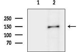 anti-Myosin IIIB (MYO3B) (C-Term) antibody