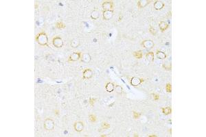 Immunohistochemistry of paraffin-embedded rat brain using Casp8 antibody (ABIN5997368) at dilution of 1/100 (40x lens). (Caspase 8 抗体)