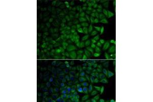 Immunofluorescence analysis of HeLa cells using CD1D Polyclonal Antibody (CD1d 抗体)
